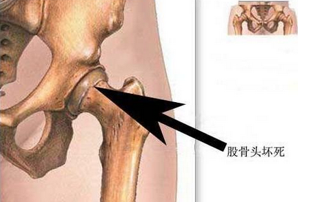 性传播疾病有哪些症状