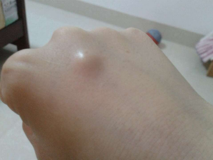 早泄都需检查什么