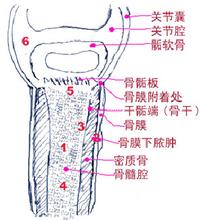 骨髓炎应注意哪些