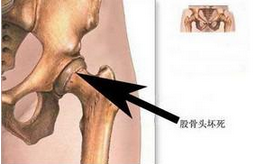 诊断男科有哪些