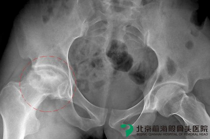 有效的诊断男科