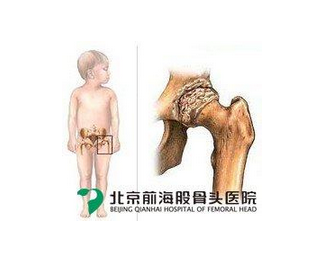 诊断男科有什么措施