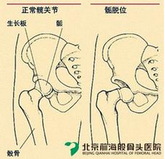 男科的治疗误区