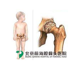 男科的病因