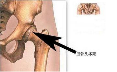 治疗男科的知识