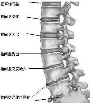 弱精症症的护理