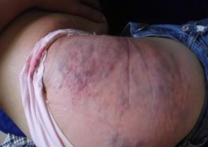 男科症状有什么